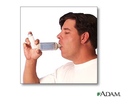 Spacer use - part six