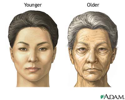 Changes in face with age Changes in face with age