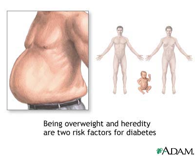 Diabetes risk factors
