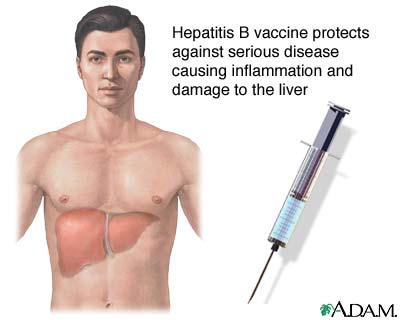 Hepatitis B