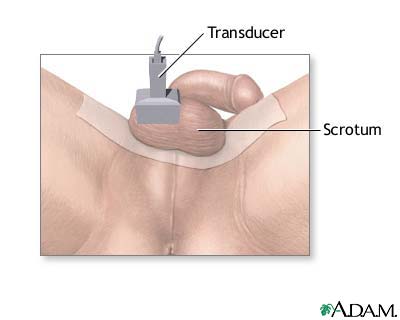 Testicular ultrasound Testicular ultrasound